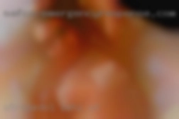 Otropedo1 Lehi UT
